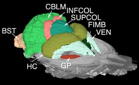 Brain slices can also be computer-combined into labeled 3-D anatomical renderings 