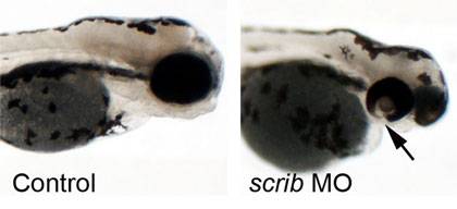 An embryonic zebrafish with a copy-number error in its genes (at right) shows a characteristic eye defect called coloboma. An unaffected fish is at left. Photo credit (Christelle Golzio, Duke University)