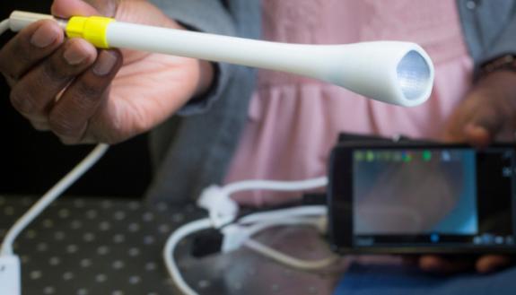 A prototype of the speculum-free “pocket colposcope” being developed by Duke University produces images on a smart phone or laptop and can make cervical cancer screening more accessible to women living in low-resource areas.