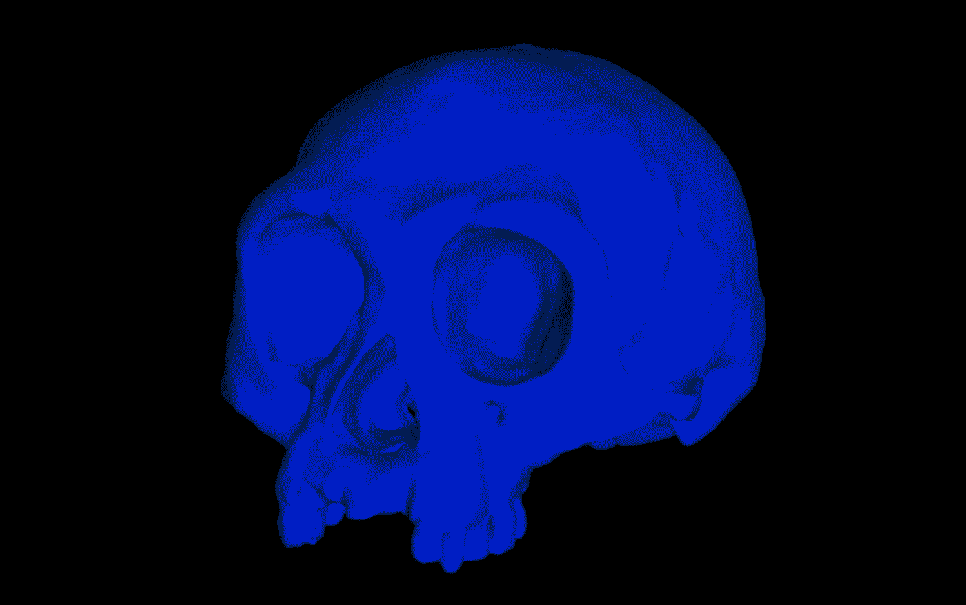 A computer simulation of a Homo floresiensis cranium shows the pattern of stress and strain in the bones of the face during biting. Areas under high strain are shown in white, pink and red. Credit: Ledogar lab, Duke University