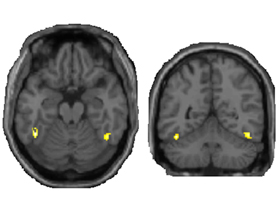 New fMRI data show that vision is more complex than scientists previously thought. 