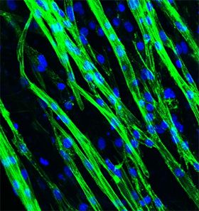 Heart muscle cells align in an orderly fashion. Nucleii are stained blue. 