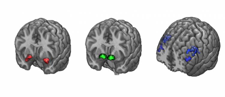 Three brain scans show the locations of the dorsolateral prefrontal cortex, the amygdala, and the ventral striatum