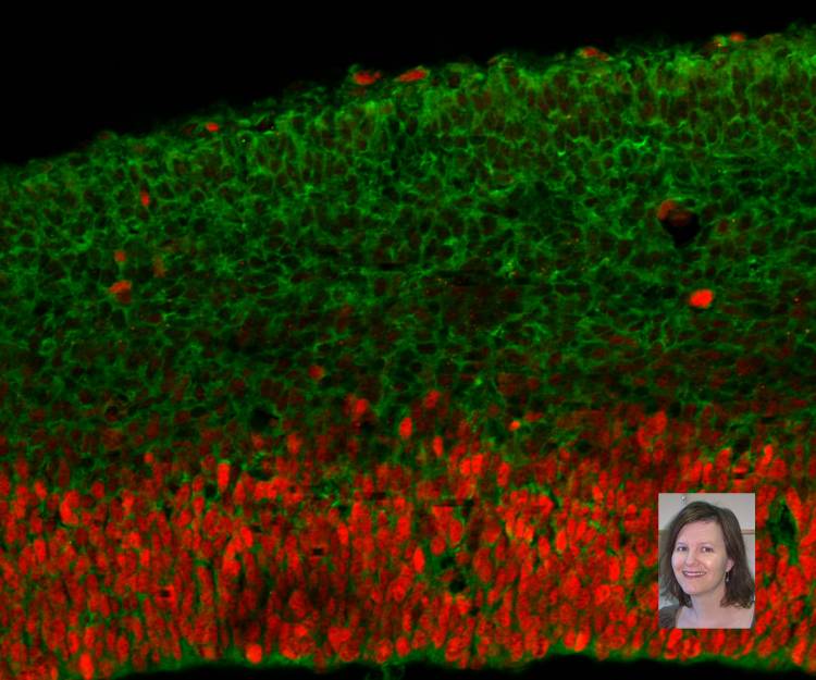 Debra Silver, activity of DDX3X gene in a mouse brain