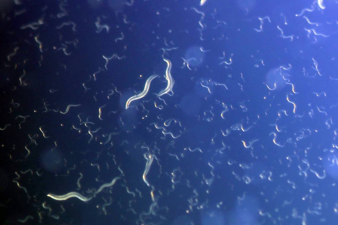 C. elegans worms whose mothers didn’t get enough to eat during pregnancy cope better with famine. Photo by Richard Pell, Carnegie Mellon.