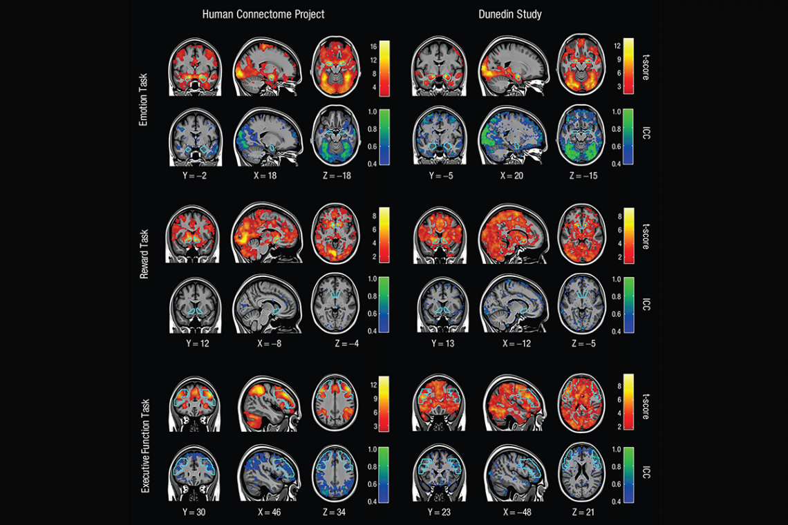 Brain scans showing functional MRI mapping for three tasks across two different days. Warm colors show the high consistency of activation levels across a group of people. Cool colors represent how poorly unique patterns of activity can be reliably measure
