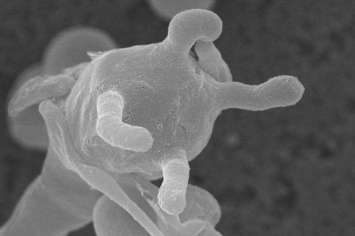 This image shows spores on the surface of a fruiting structure from the fungus Cryptococcus deuterogattii, a deadly strain that emerged in the Pacific Northwest. CREDIT: Edmond Byrnes III, Joseph Heitman -- Duke; Valerie Knowlton – NC State)