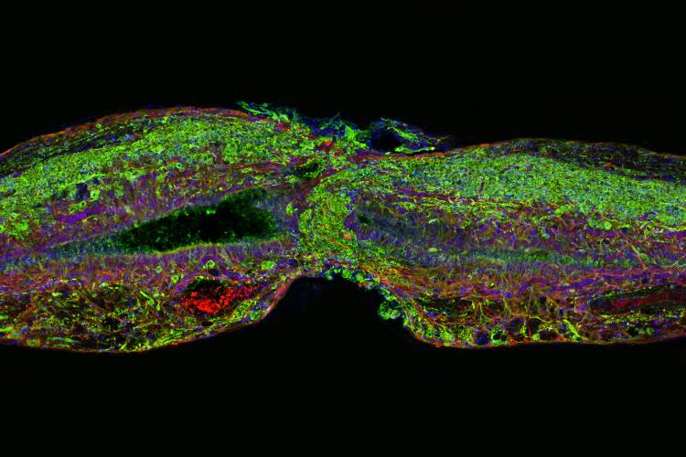 Adult zebrafish can regenerate their spinal cords after an injury. Supporting glial cells (shown in red) are first to bridge the gap between the severed ends. Neuronal cells (green) soon follow. Photo credit: Mayssa Mokalled and Kenneth Poss, Duke