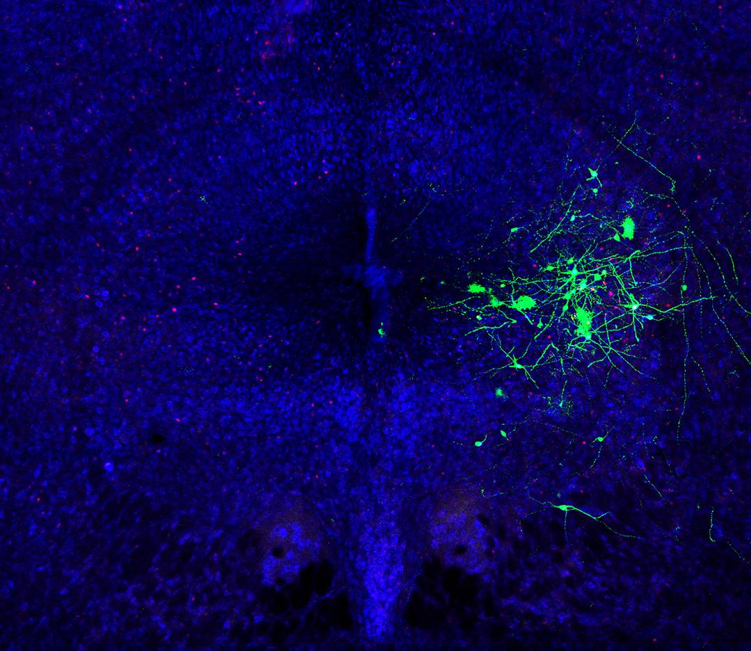 Green fluorescent proteins mark the location of neurons in the mouse’s mid-brain that are integral to vocalizations for wooing. (Mooney Lab, Duke)