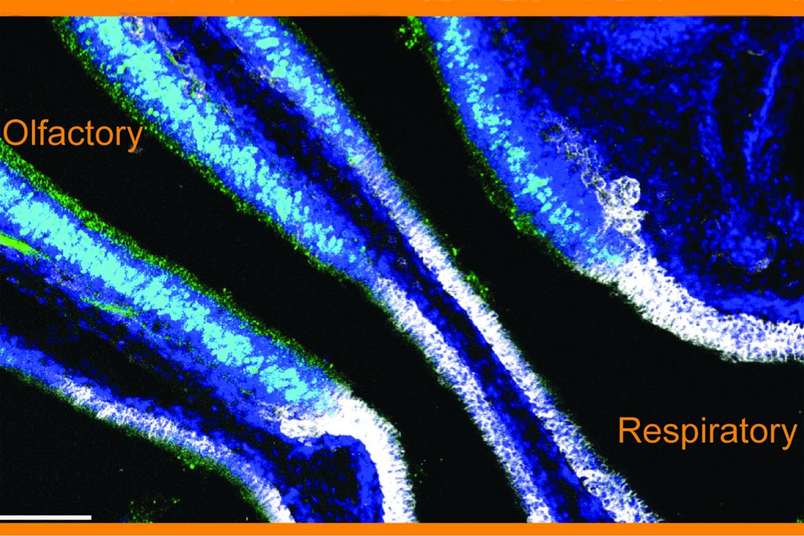 Circulating antibody (white) is prevented from accessing olfactory epithelium (green) by a previously unknown blood-olfactory barrier, the BOB. (Ashley Moseman Lab, Duke University)