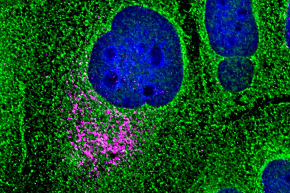 Dengue virus infection in a cultured cell is revealed by the magenta color, showing that the virus has localized to the endoplasmic reticulum of the host cell. (Jessica Child - Nicchitta Lab)