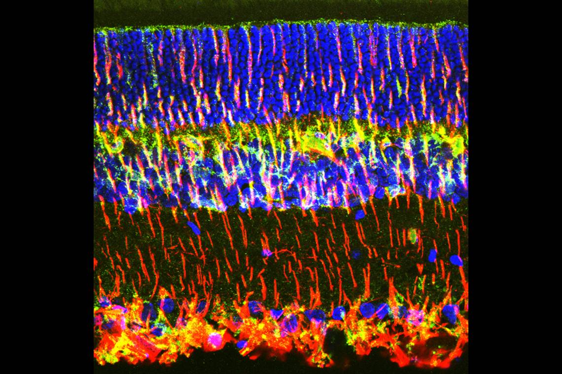 A microscopy image with retinal cells stained bright blue, green, red and orange