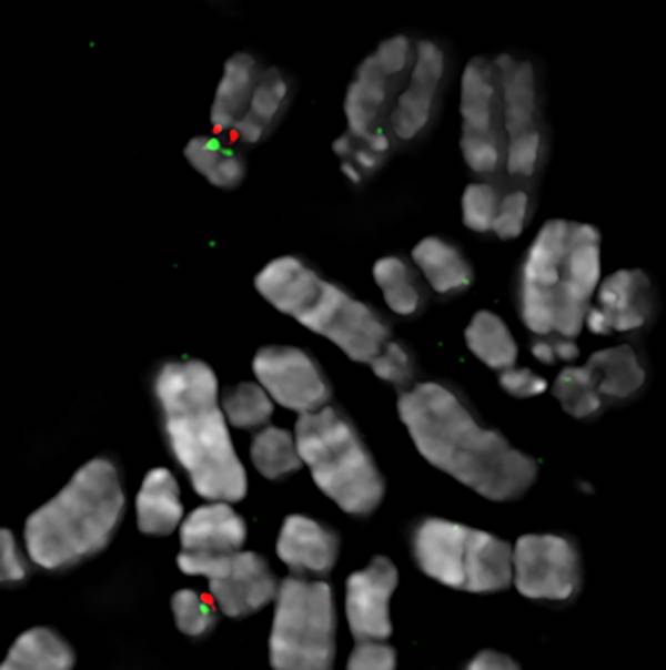 A set of human chromosomes with the “primary” and “backup” sites for centromere assembly on chromosome 17 painted in red and green, respectively.  Credit: Beth Sullivan, Duke University