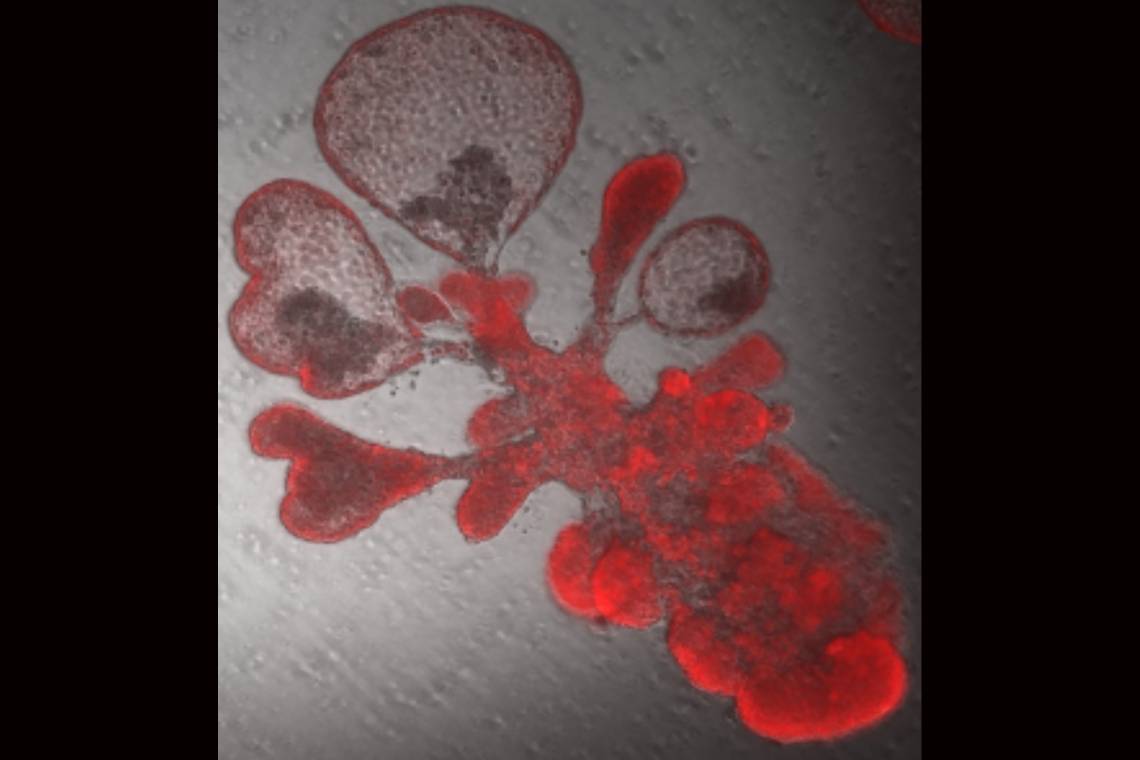 A single lung stem cell copied itself to generate thousands of cells and generate a bubble-like structure that resembles breathing tissues of the human lung. These are the cells that the SARS-CoV-2 virus targets. Image credit: Arvind Konkimalla/Tata lab