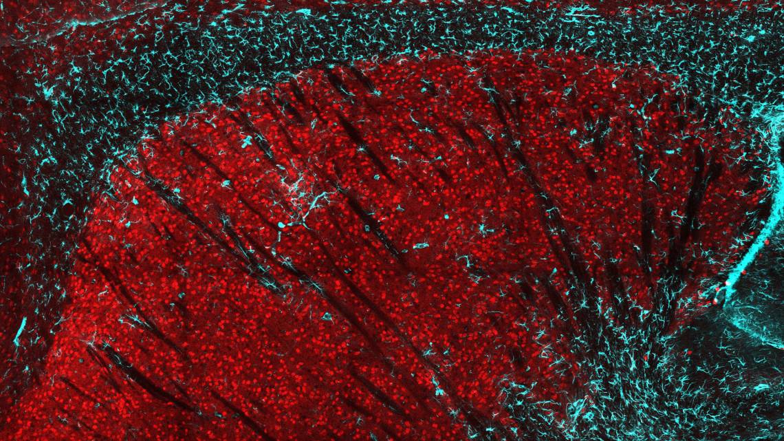 A cross-section of the striatum in a mouse brain. Loss of huntingtin protein in striatal neurons (red) causes neuron loss and an inflammatory response, shown by the infiltration of glial astrocytes (cyan). (Caley Burrus, Duke)