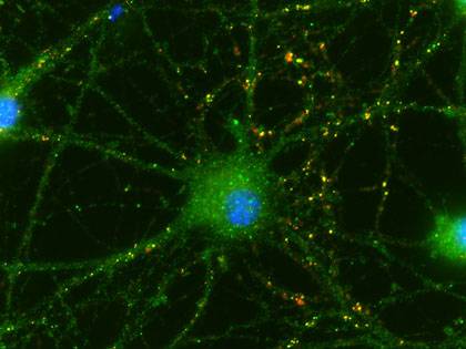 Cells isolated from newborns’ umbilical cords help neurons make new connections (shown in yellow) with their neighbors. Image credit: Sehwon Koh, Duke University