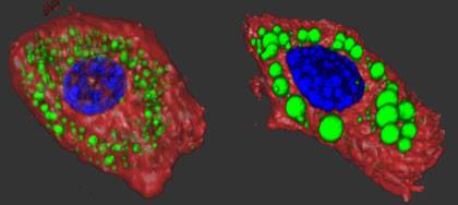 Fat cells with the R1788W ankyrin-B mutation (shown on the right) have enlarged lipid droplets. The green color highlights the sites of fat storage in mouse adipose cells. Nuclei are shown in blue. Photo credit: Damaris Lorenzo