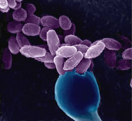 A false color scanning electron micrograph shows infectious spores of Cryptococcus fungi (purple) decorating the surface of the specialized structure where they are produced.  Photo courtesy Joseph Heitman and Edmond Byrnes