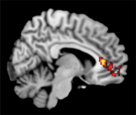graphic image of brain