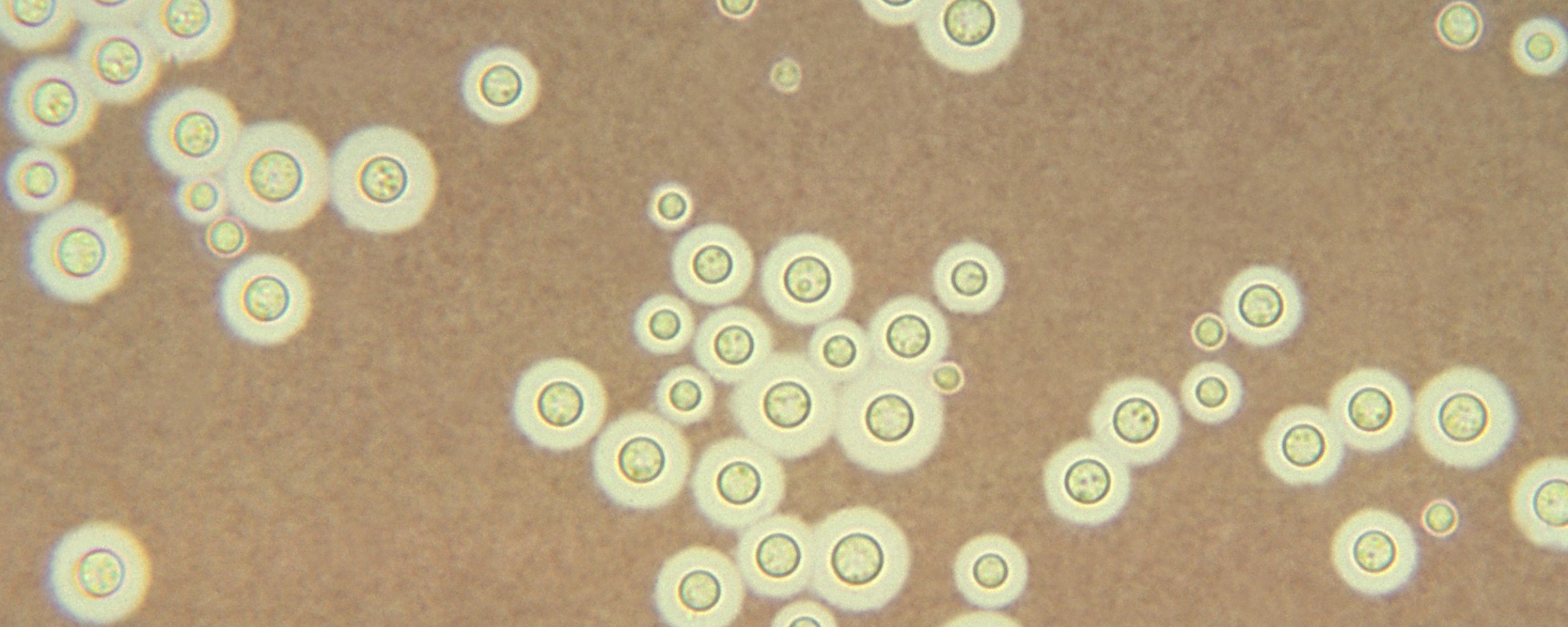 Esta fotomicrografia mostra Cryptococcus neoformans
