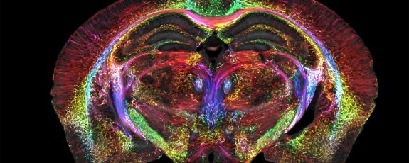 Multicolor image of a mouse brain in coronal cross-section