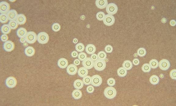 photomicrograph of cryptococcus spores, yellow spheres on a brown background