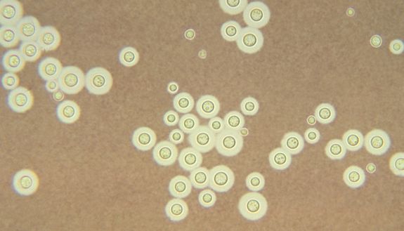 photomicrograph of cryptococcus spores, yellow spheres on a brown background
