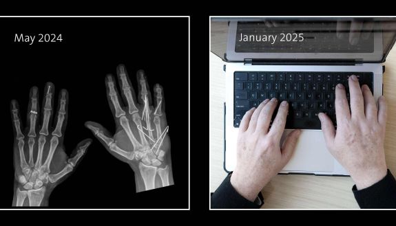 on the left shows a hand xray and on the right shows a person typing at the computer