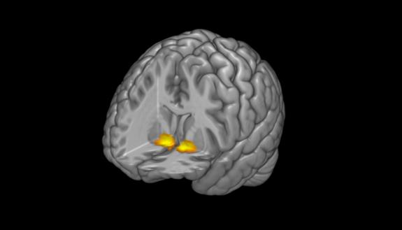 A 3D fMRI image of a brain with a cut out highlighting the location of the ventral striatum