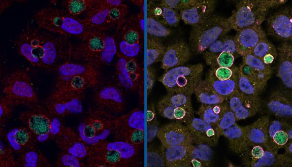 Left: Chlamydia (green) surrounded by the GarD protein (red) that cloaks it from detection. Right: Chlamydia with GarD knocked out (green) enveloped by antimicrobial ubiquitin proteins (yellow) and RNF213 (magenta). (Stephen C. Walsh, Duke University)