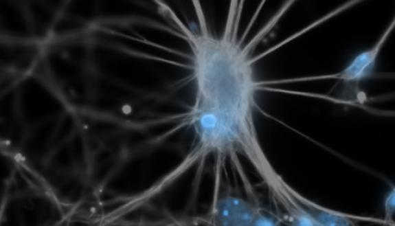 A neuron from a mouse brain. From Wikimedia Commons.