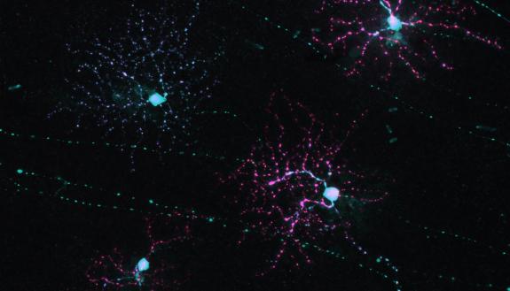 This image from a confocal microscope shows four retinal ganglion cells, the cells that send a signal from the retina to the brain. (Marija Rudzite, Duke University)