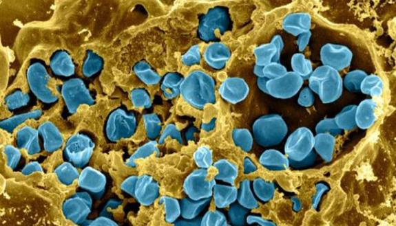 This scanning electron micrograph shows a mouse immune cell (yellow) infected with Francisella tularensis bacteria (blue). Credit: National Institute of Allergy and Infectious Disease.