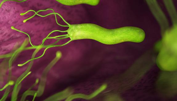 Bug That Causes Stomach Cancer Could Play a Role in Colorectal Cancer