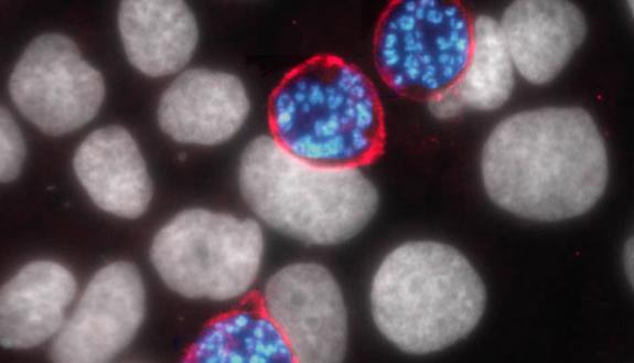 A microscope image of the Plasmodium parasite inside liver cells