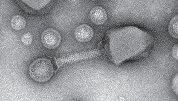 photo of a phage virus trapped by its prey