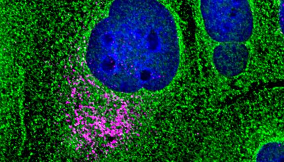 Dengue virus infection in a cultured cell is revealed by the magenta color, showing that the virus has localized to the endoplasmic reticulum of the host cell. (Jessica Child - Nicchitta Lab)