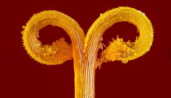 Zinnia stamen by Thomas Barlow, Duke University