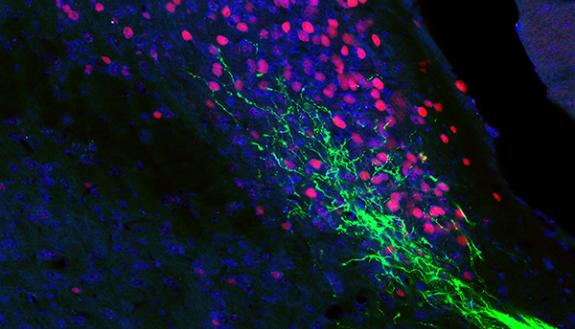 Green string-like neurons extend into a sea of pink dots