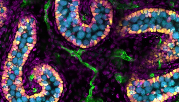 Imaged by Victor Ruthig, PhD, postdoctoral fellow, Blanche Capel lab in Cell Biology