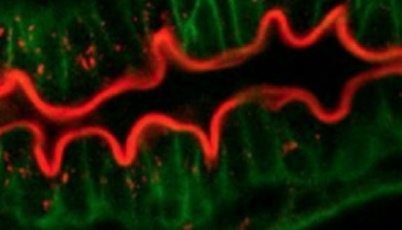 The developing gut of a zebrafish, magnified.
