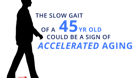 A long-term study has found that signs of aging may be detected by a simple walking test at age 45, and that the brains of slower walkers were different at age 3. 