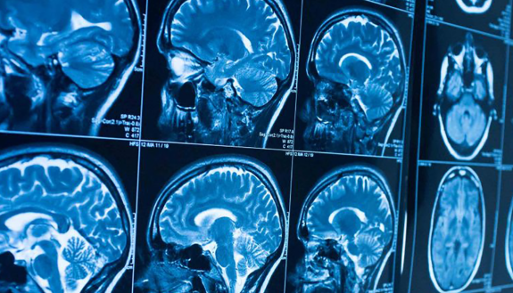 Screen of Brain scans