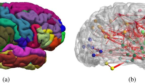 Graph theory allows researchers to model the structural and functional connection between regions of the brain. Image courtesy of Shu-Hsien Chu et al