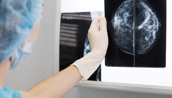 a game changing treatment for breast cancer still remains a mystery as to why it works.