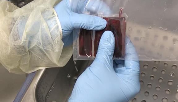 doctor with cord blood
