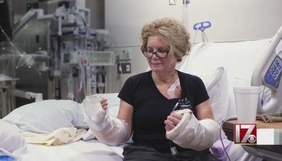 Deb Kelly following the hand transplant