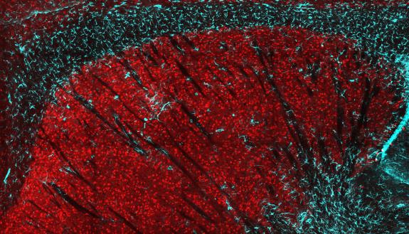 A cross-section of the striatum in a mouse brain. Loss of huntingtin protein in striatal neurons (red) causes neuron loss and an inflammatory response, shown by the infiltration of glial astrocytes (cyan). (Caley Burrus, Duke)