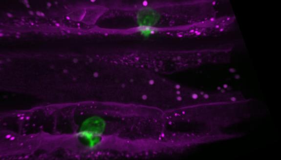 Magnified hundreds of times, these green cells in C. elegans worms can change their tactics to get around once-promising cancer drugs and trespass into other tissues. The findings may point to better ways to block cancer’s spread. Laura Kelley, Duke Univ.