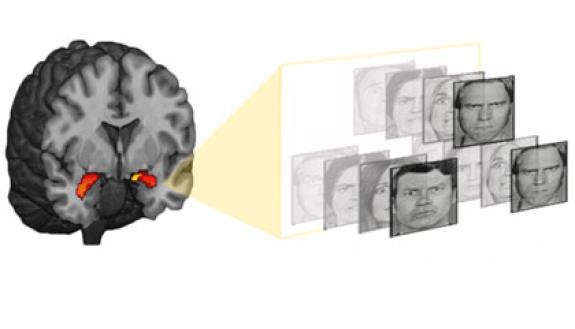 Looking at angry or fearful faces triggers the amygdala -- a brain structure that controls our responses to danger -- more intensely in some people than in others. Photo credit – Hariri lab, Duke University